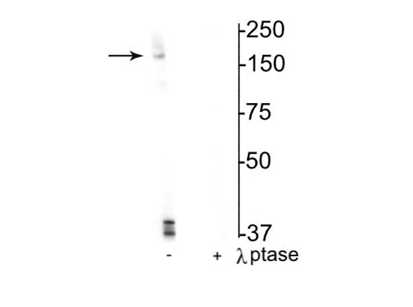 Western blot of Anti-NMDA NR2B Subunit pS1166 Antibody